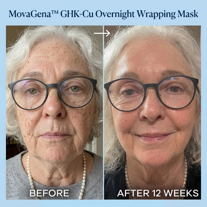 Before and after 12 weeks with GHK-Cu copper peptide peel-off mask